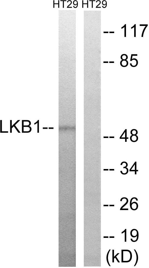 STK11 / LKB1 Antibody (p334)