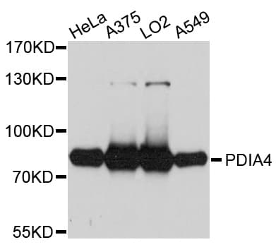 Polyclonal Rabbit anti-Human PDIA4 / ERP72 Antibody (IHC, WB)