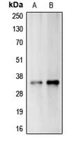 CA14 / Carbonic Anhydrase XIV Antibody (Internal)