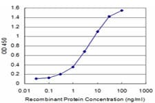 Monoclonal Mouse anti-Human AXIN1 / Axin-1 Antibody (clone 2B11, IF, WB)