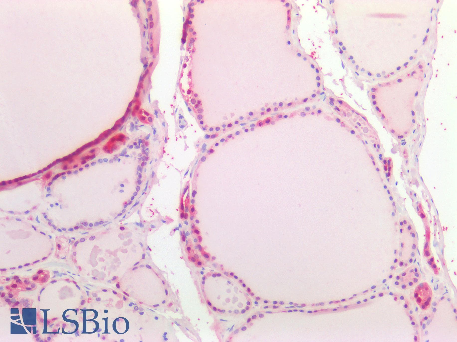 PathPlus™ OCLN / Occludin Antibody