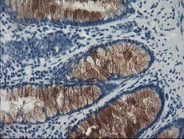 FBXO42 / JFK Antibody (clone OTI2G7)