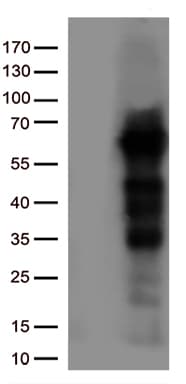 IRF3 Antibody (aa27-169, clone OTI8G9)