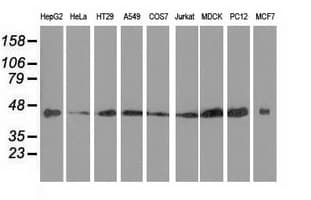 Monoclonal Mouse anti-Human DNAJA2 Antibody (clone OTI2A2, IHC, IF, WB)