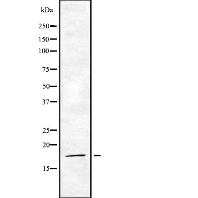 Polyclonal Rabbit anti-Human EIF5A2 Antibody (WB)