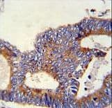 Polyclonal Rabbit anti-Human HSPA5 / GRP78 / BiP Antibody (aa541-568, IHC, WB)