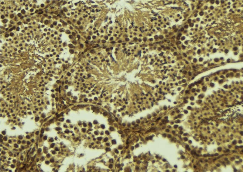 SIVA1 / SIVA Antibody
