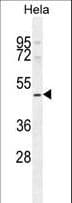Polyclonal Rabbit anti-Human SMYD1 Antibody (aa420-449, WB)