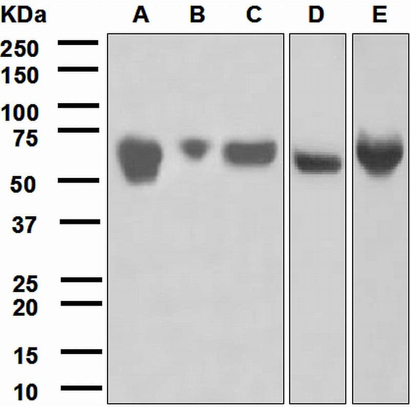IHC-plus™ AGT / Angiotensinogen Antibody (Internal, clone EPR2930(2))