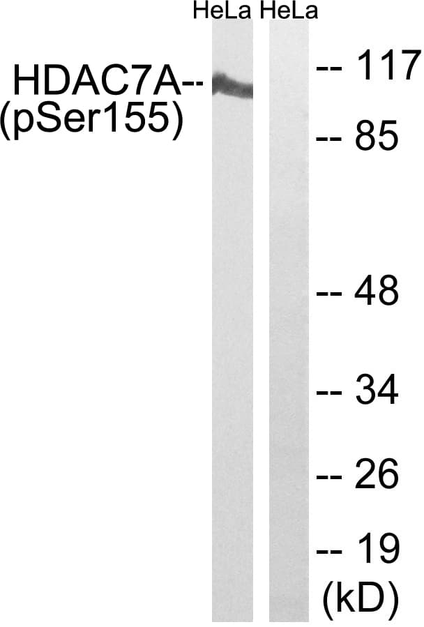 HDAC7 Antibody (phospho-Ser155)