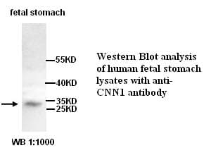 CNN1 / Calponin Antibody
