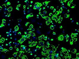 ATP5B / ATP Synthase Beta Antibody (clone OTI3H8)