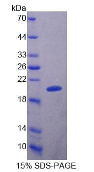 Human BM022 / MRPL1 Protein (Recombinant His-T7)