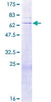 Human LIG3 / DNA Ligase III Protein (Recombinant GST)