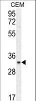 C11orf74 Antibody (aa190-220)