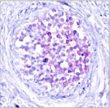 Polyclonal Rabbit anti-Human RAF1 / RAF Antibody (WB)