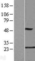 Human GLO1 / Glyoxalase I Protein (Over-Expression Lysate Myc-DDK (Flag))