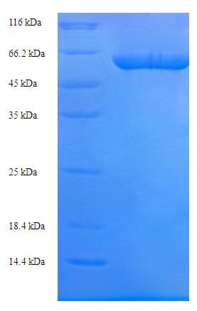 Human EFTU / TUFM Protein (Recombinant His-SUMO)