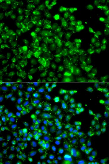 Polyclonal Rabbit anti-Human CAPN5 / Calpain 5 Antibody (AP, IHC, IF, WB)