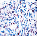 Polyclonal Rabbit anti-Human STAT3 Antibody (IHC, WB)