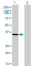 Monoclonal Mouse anti-Human TSTA3 / GDP-L-Fucose Synthase Antibody (clone 2B9, WB)