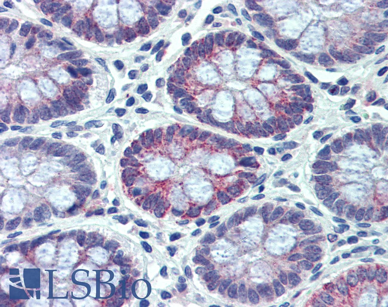 IHC-plus™ NR1I2 / PXR Antibody (aa406-420)