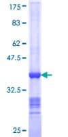 Human NEDD1 Protein (Recombinant GST, N-terminus)