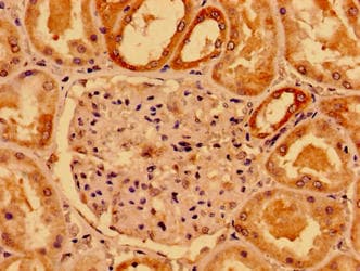 Polyclonal Rabbit anti-Human SMAD4 Antibody