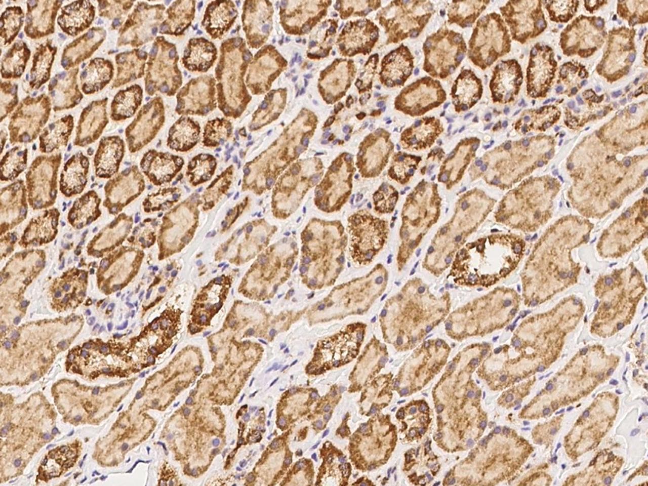 Polyclonal Rabbit anti-Human MFSD11 / ET Antibody (IHC)