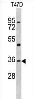 KLF6 Antibody (aa56-82)
