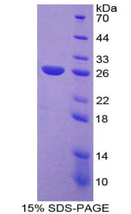 Human NUP133 Protein (Recombinant His-T7)