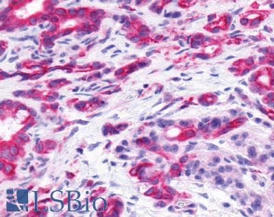 PathPlus™ Prostaglandin D2 Receptor Antibody (Extracellular Domain)