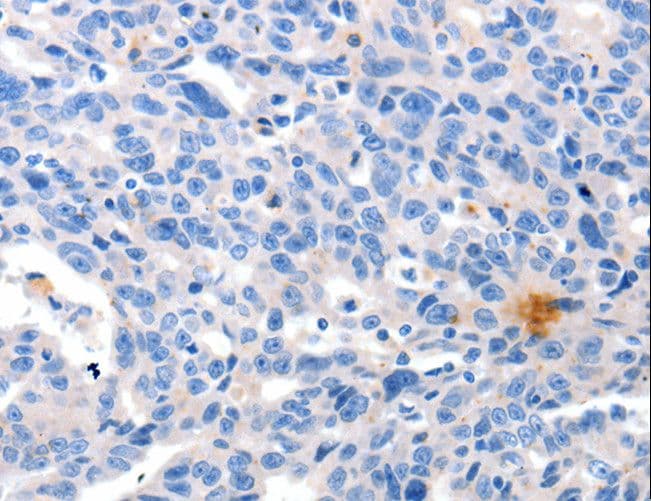 GRIN2D / NMDAR2D / NR2D Antibody