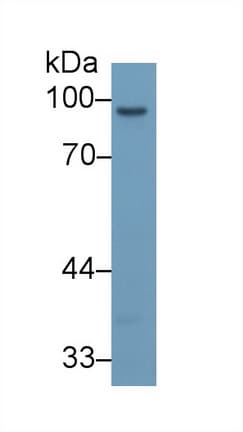 MMP9 / Gelatinase B Antibody
