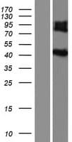 IL5RA / CD125 Protein (Over-Expression Lysate Myc-DDK (Flag))