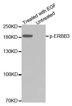 ERBB3 / HER3 Antibody (phospho-Tyr1328)