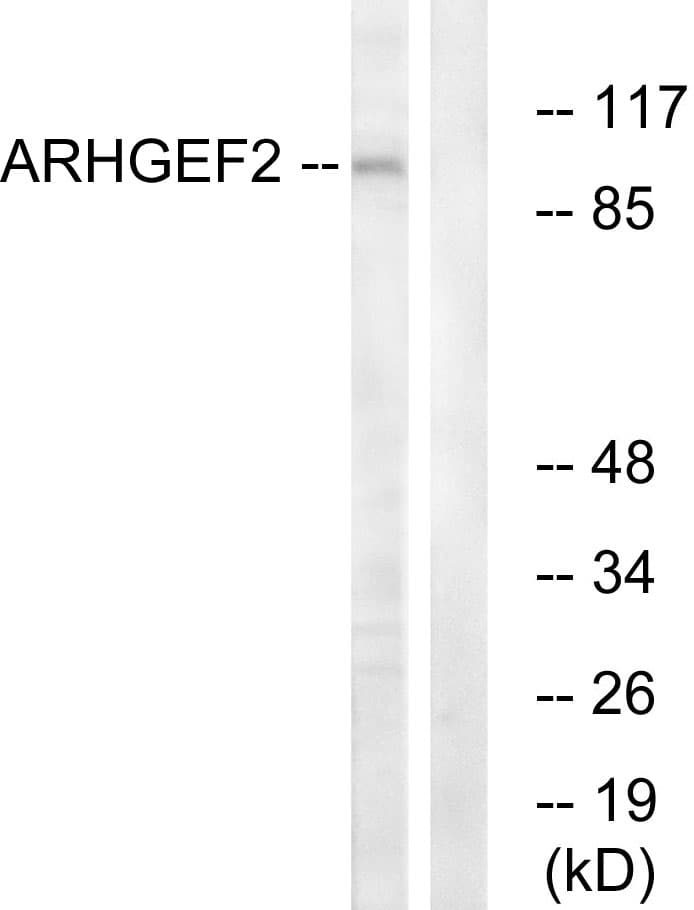 IHC-plus™ Polyclonal Rabbit anti-Human ARHGEF2 / GEF-H1 Antibody (aa383-432, IHC, WB)