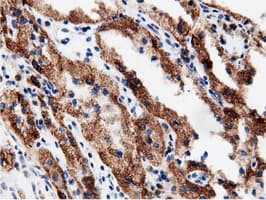 AK5 / Adenylate Kinase 5 Antibody (clone OTI2F9)