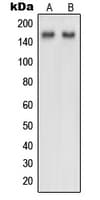 NUP160 Antibody (Internal)