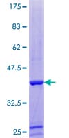 Human PFN4 Protein (Recombinant GST)