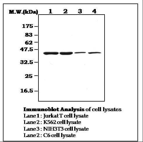 IHC-plus™ CSNK2A1 Antibody