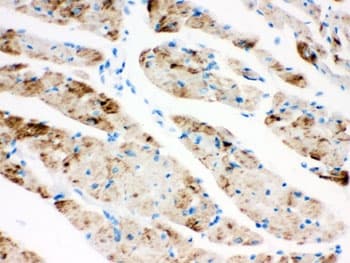 CPT1B Antibody
