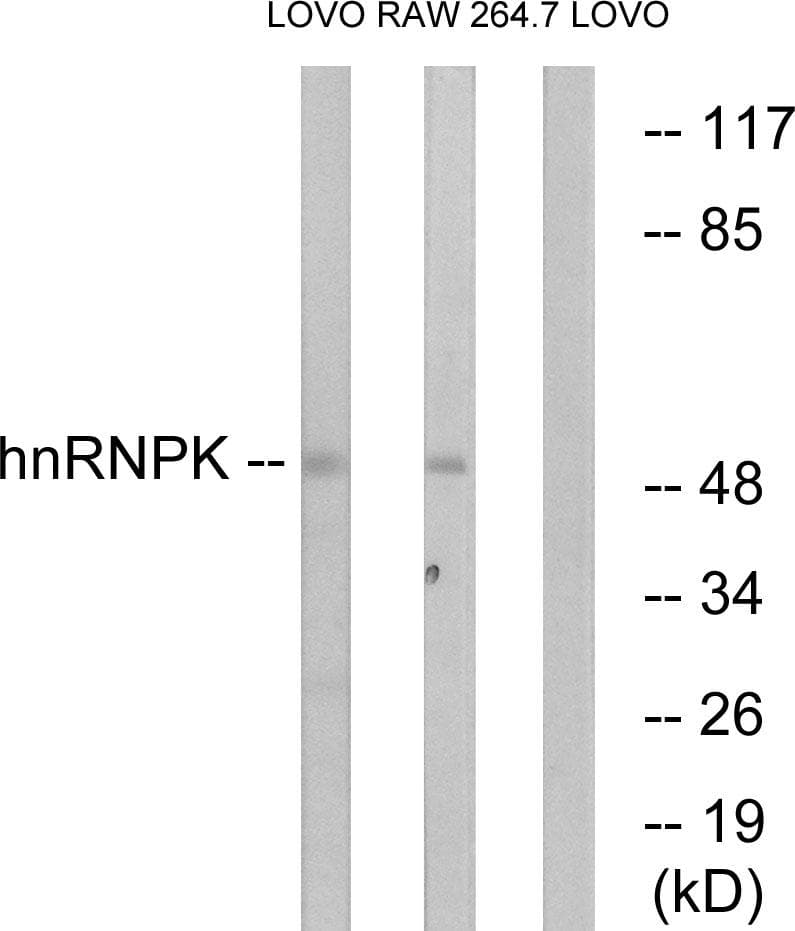 HNRNPK / hnRNP K Antibody (p284)