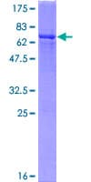 Human GMPPB Protein (Recombinant GST)