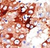 Polyclonal Rabbit anti-Human ACSL4 / FACL4 Antibody (aa236-267, IHC, IF, WB)