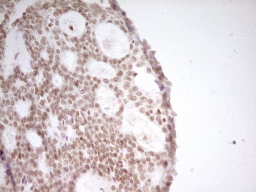 NR2C2 / TAK1 Antibody (aa1-241, clone OTI1F3)