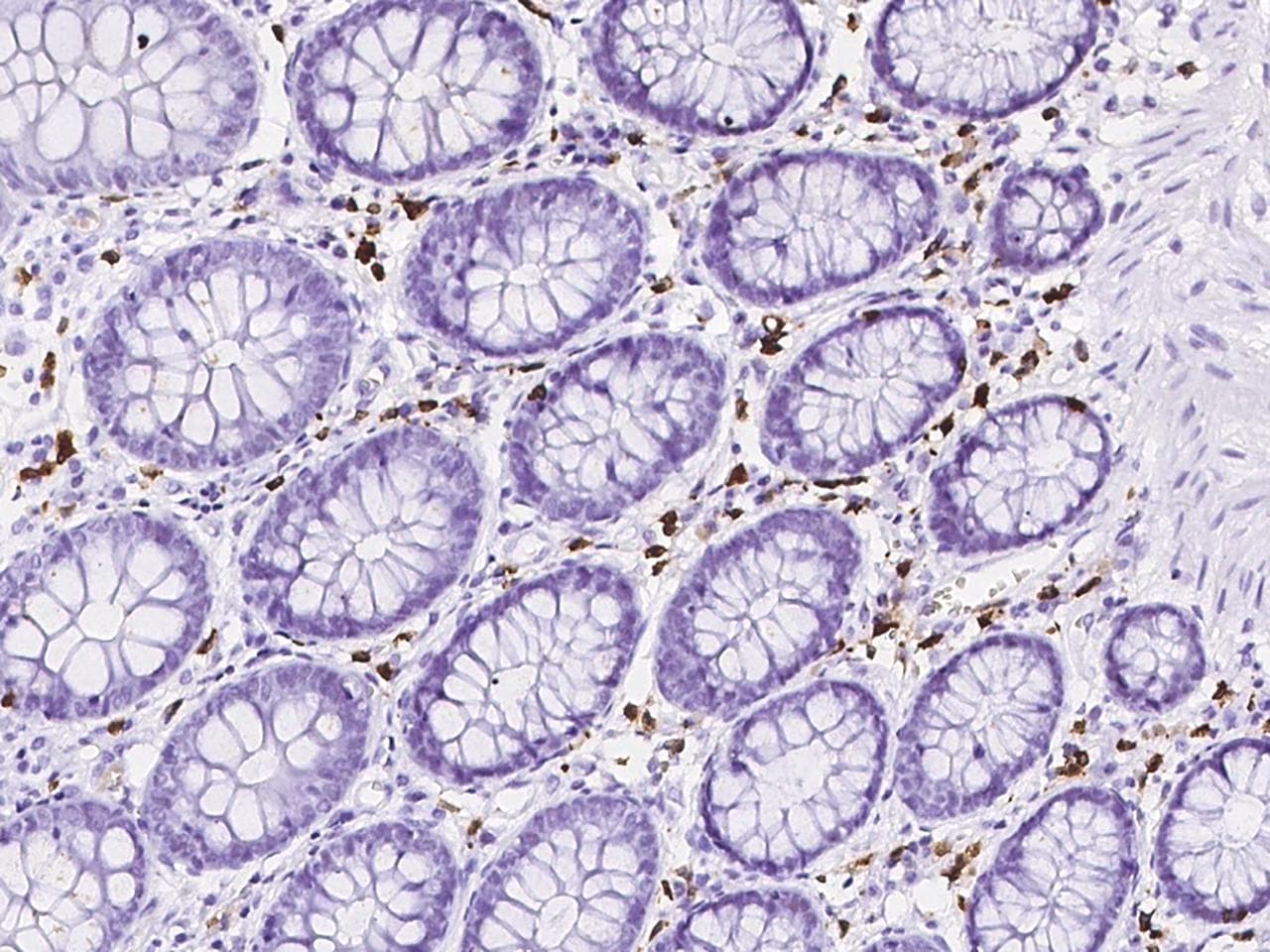IL2RG / CD132 Antibody (Preservative Free)