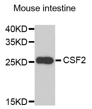 CSF2 / GM-CSF Antibody