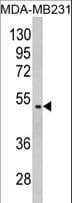 Polyclonal Rabbit anti-Human GALT Antibody (aa344-373, IHC, WB)