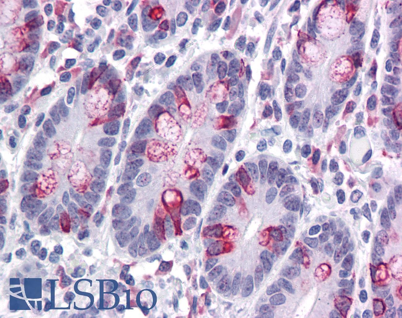 IHC-plus™ ZBED3 Antibody